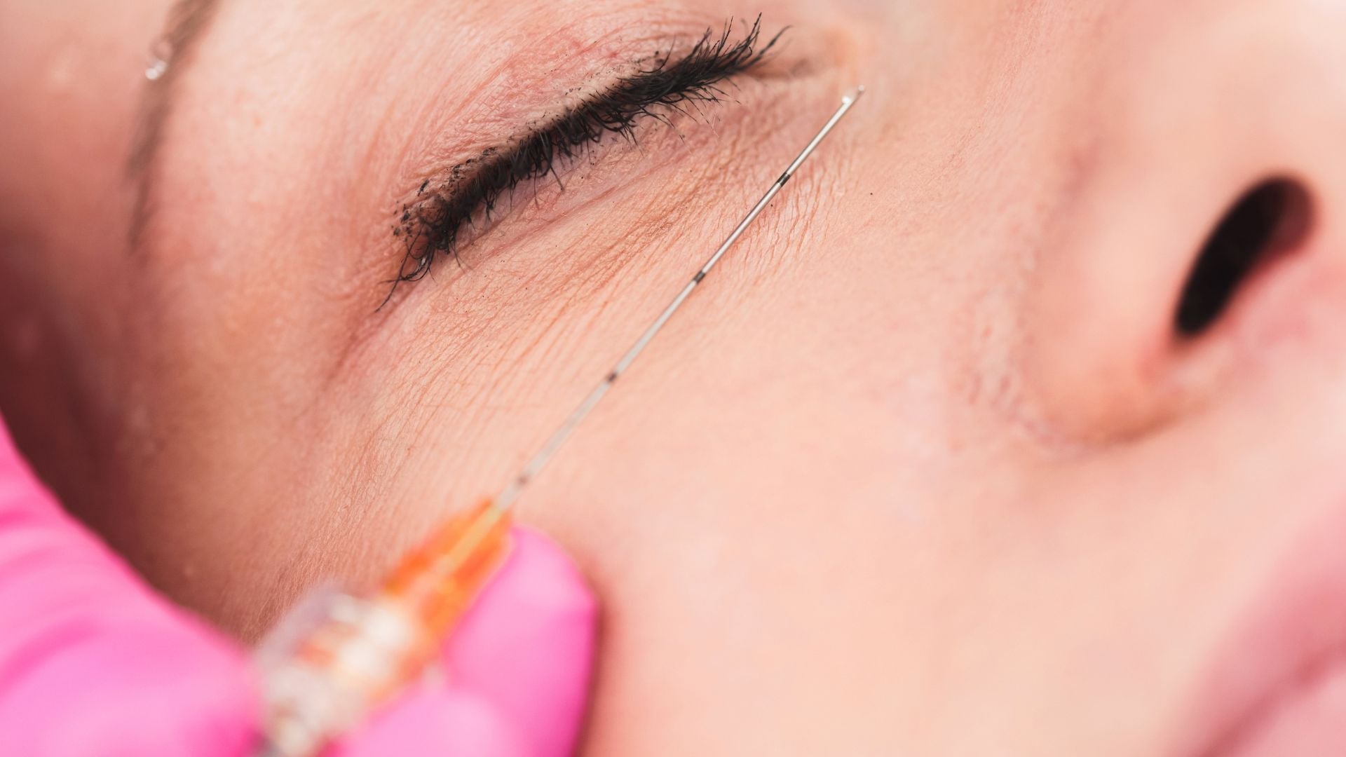 FeelSoft® Micro Filler Cannulas