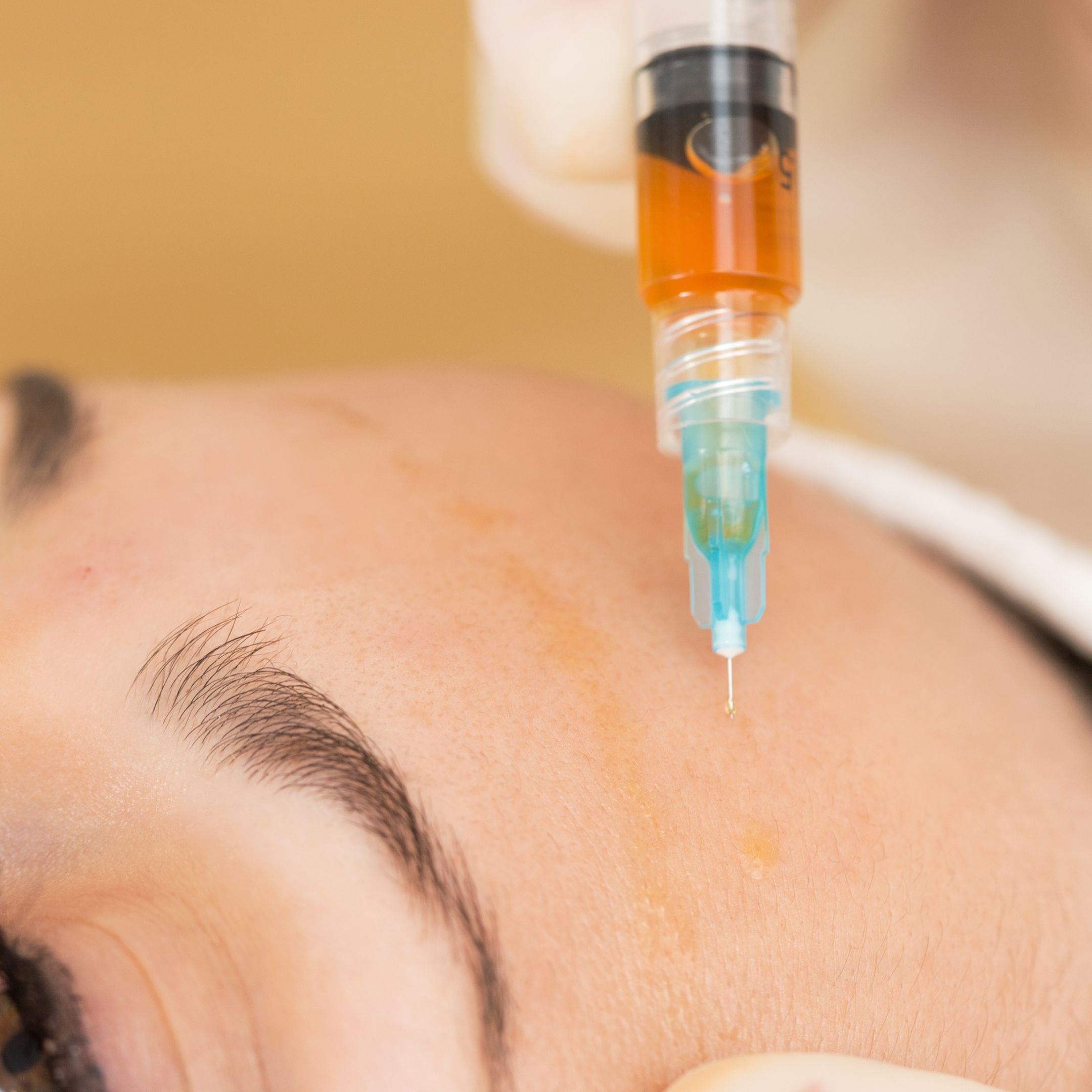 FeelSoft® Meso Needles