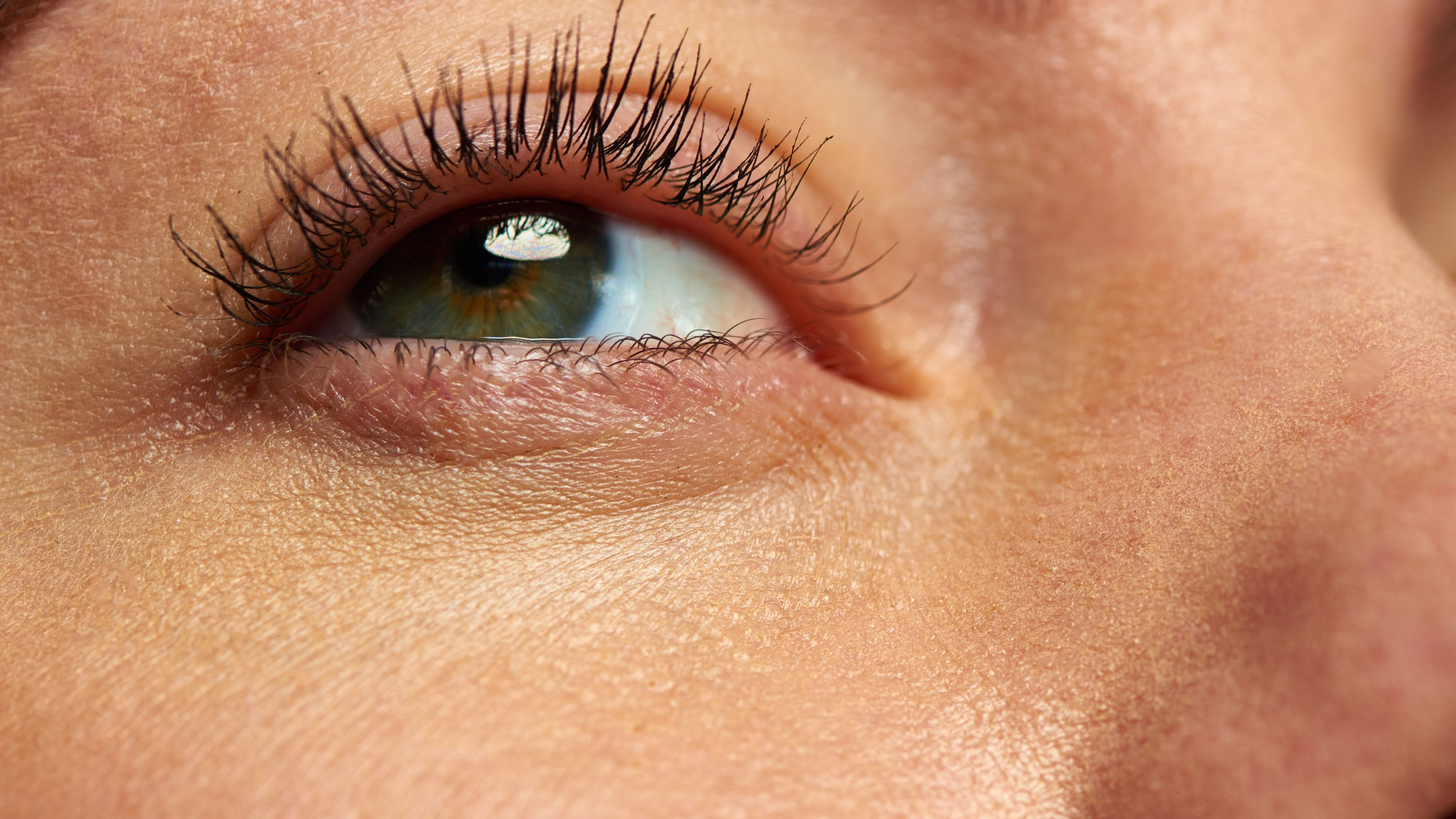 FeelSoft® Micro Cannulas and Meso Needles