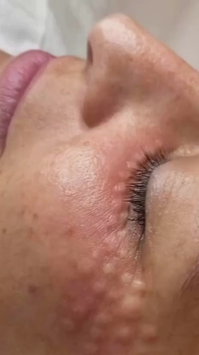 MicronJet™ 600 / 0.6mm (Box of 30)